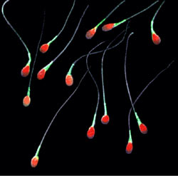 sperm-20051108.jpg